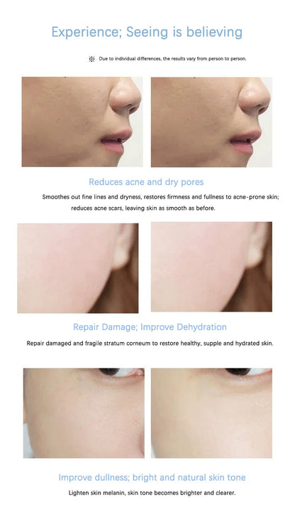 Placenta Freeze-Dried Powder Essence — Hydrating, Nourishing & Skin Rejuvenation Serum for Pore Shrinking