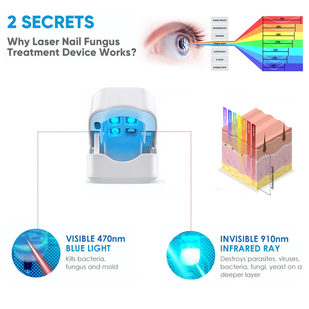 Nail Fungus Treatment Tools – Effective Anti-Fungal Equipment for Toenail & Nail Infection Removal