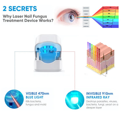 Nail Fungus Treatment Tools – Effective Anti-Fungal Equipment for Toenail & Nail Infection Removal