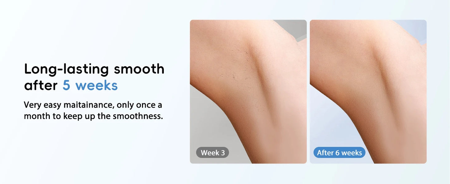IPL Hair Removal Laser 22J — Unlimited Flashes IGBT, 5.2cm² Light Painless Epilator for Face, Armpit & Bikini Body Treatment