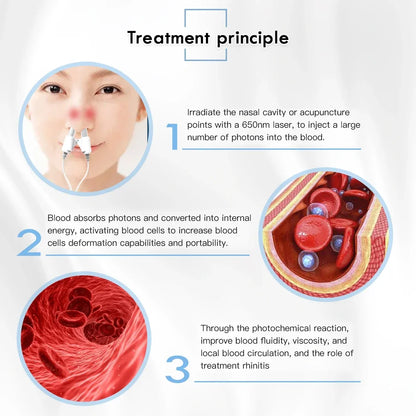 Portable Tinnitus Ear Laser Therapy – 650nm LLLT Irradiation Earplugs for Otitis Media, Deafness, Rhinitis & Sinusitis Treatment
