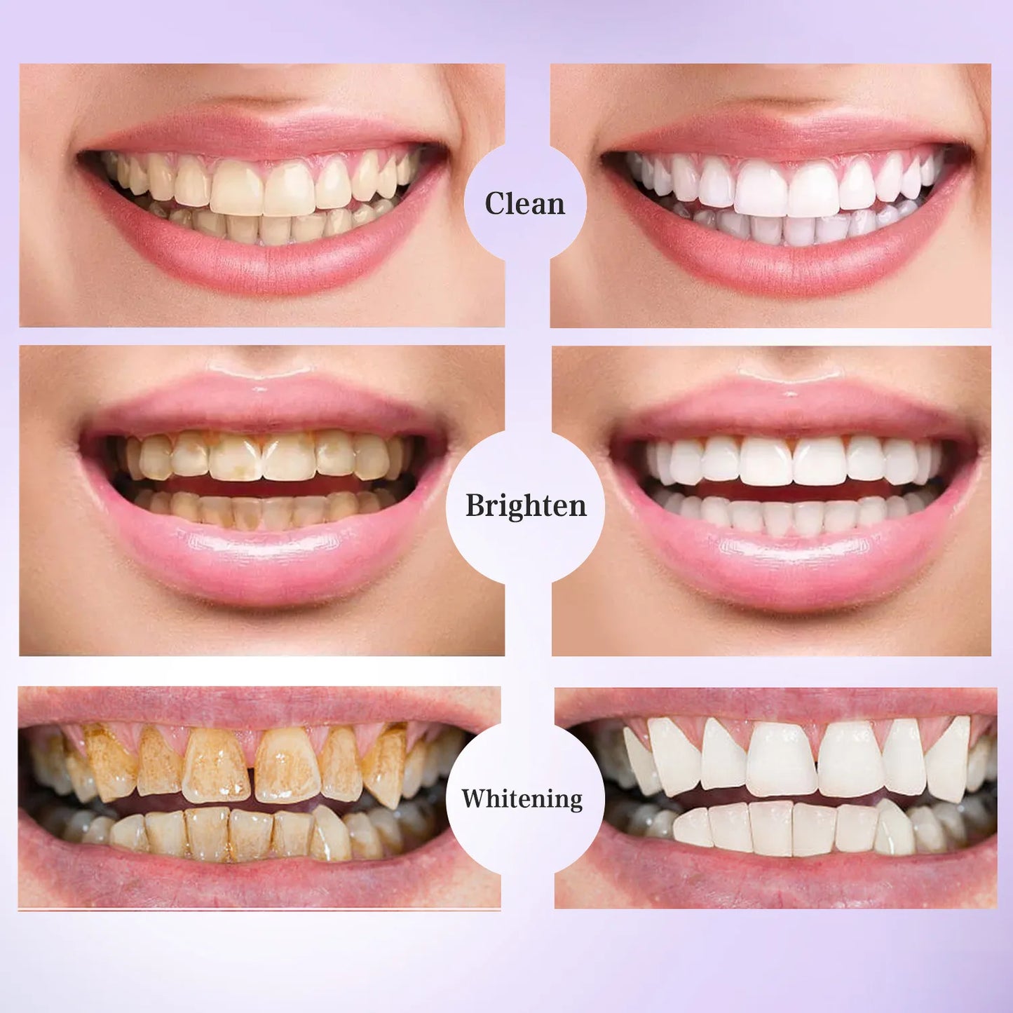 5D Whitening Teeth Stickers – 7/14 Pairs Gel Strips for Stain Removal, Dental Bleaching & Oral Hygiene Care