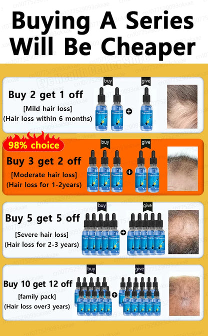 WPRBREGT Blue Hair Growth Serum — Essential Oil for Thicker Hair, Anti-Baldness Treatment