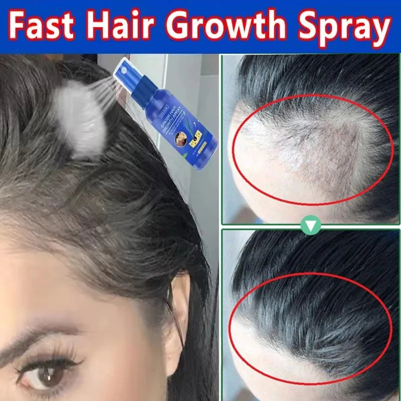 Ginger Hair Growth Serum Spray - Moisturizing Scalp Care and Nourishing Hair Treatment for Men and Women