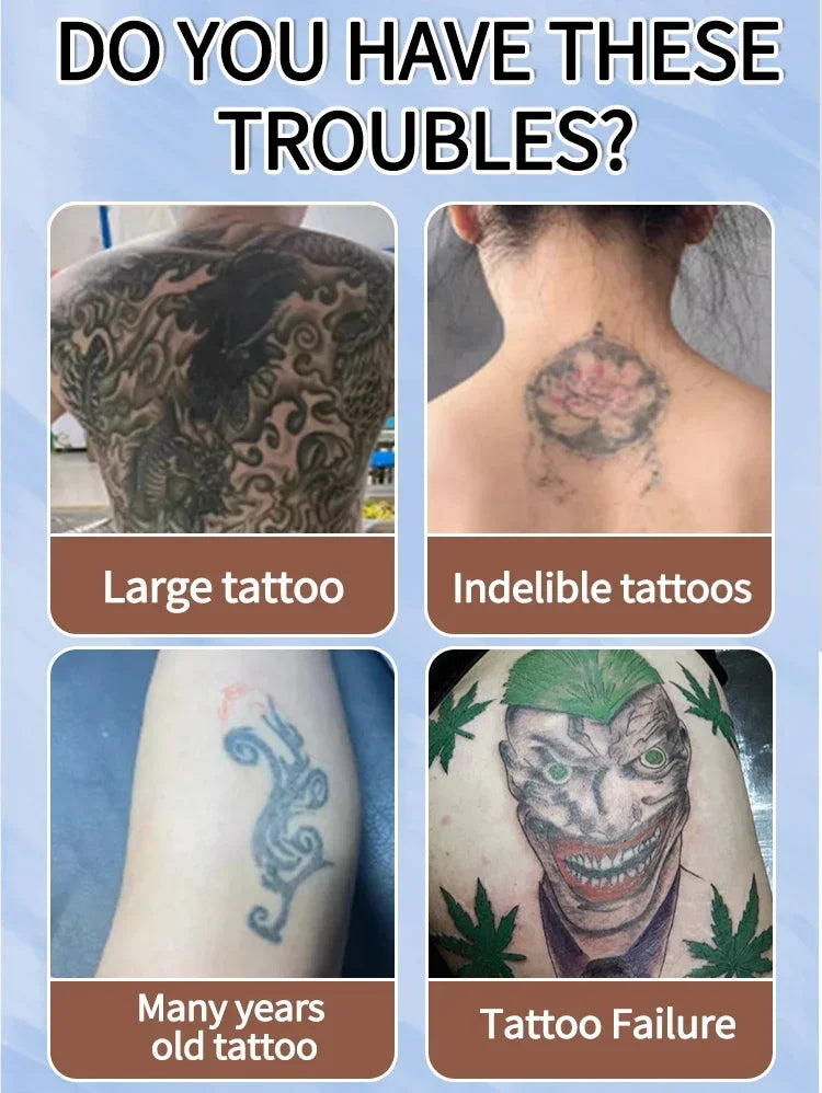 Tattoo Removal Cream – Effective for Large & Small Permanent Tattoos
