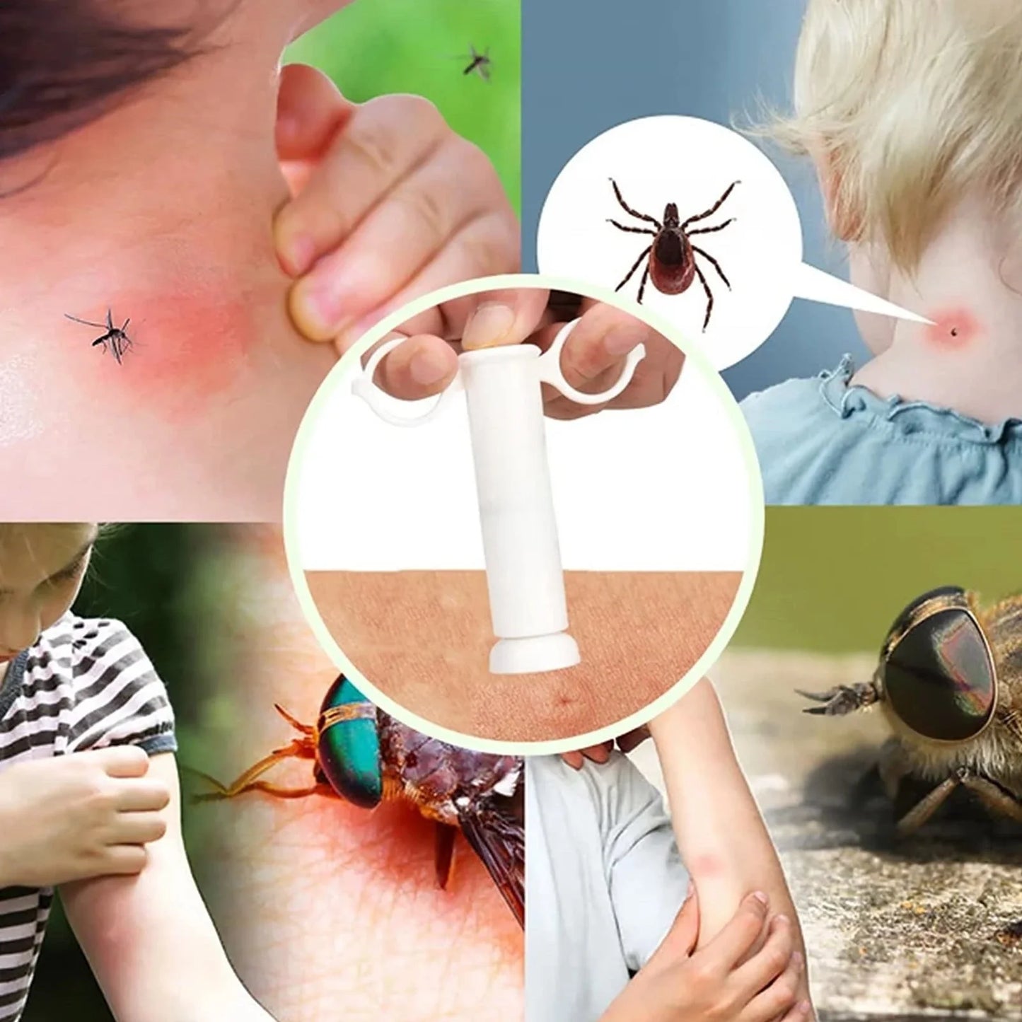 Bug Bite Suction Tool - Venom Extractor for Itch & Swelling Relief, Bite and Sting First Aid for Hiking & Outdoor Use