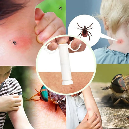 Bug Bite Suction Tool - Venom Extractor for Itch & Swelling Relief, Bite and Sting First Aid for Hiking & Outdoor Use