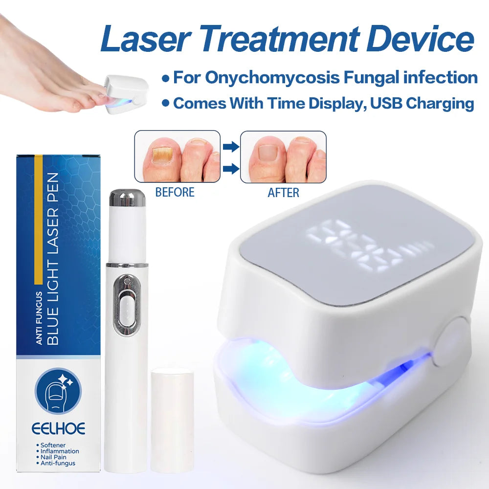 Nail Fungus Treatment Tools – Effective Anti-Fungal Equipment for Toenail & Nail Infection Removal