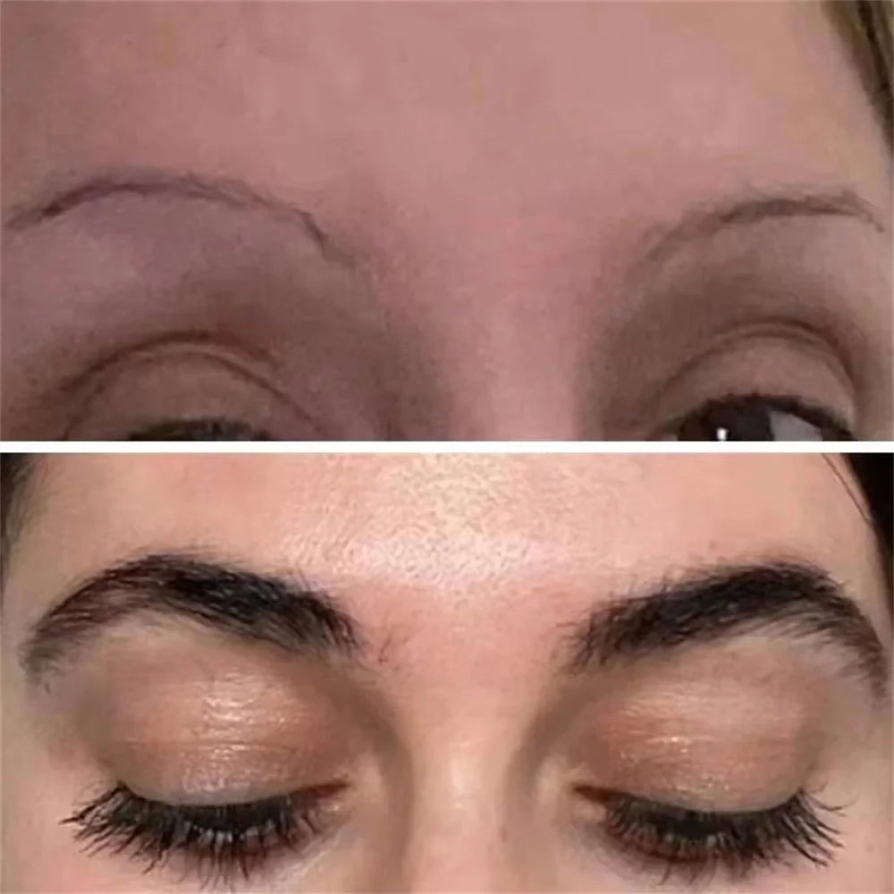 Eyebrow & Eyelash Growth Serum – Fast-Growing, Hair Loss Prevention Treatment for Fuller, Thicker Lashes and Brows