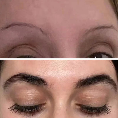 Eyebrow & Eyelash Growth Serum – Fast-Growing, Hair Loss Prevention Treatment for Fuller, Thicker Lashes and Brows