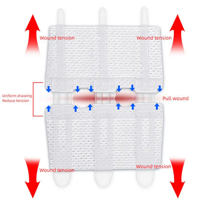 Emergency Wound Closure Strips - Zipper-Style Suture-Free Laceration Closure Device for First Aid