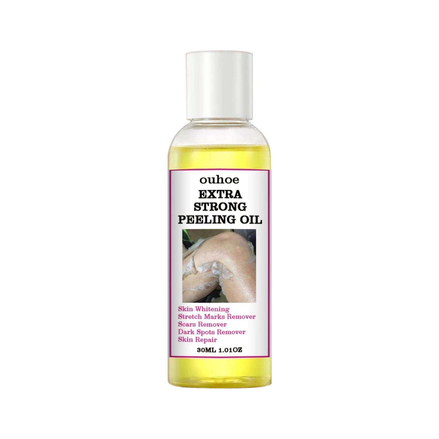 30/110ml Super Strength Body Peeling Oil — Brightening, Moisturizing & Exfoliating Skin Care Oil