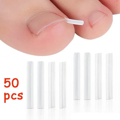 50PCS Ingrown Toenail Correction Kit – Invisible Nail Straightening Clips & Treatment Pads for Foot Care