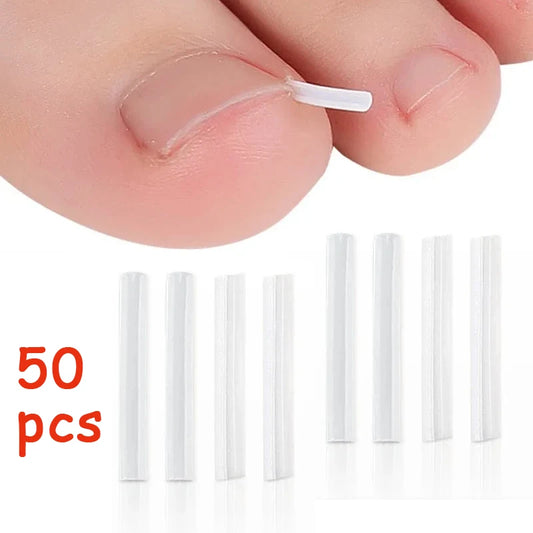 50PCS Ingrown Toenail Correction Kit – Invisible Nail Straightening Clips & Treatment Pads for Foot Care