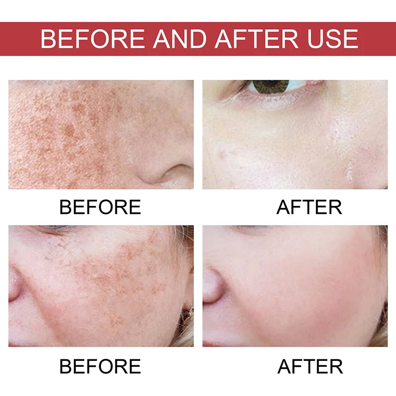Niacinamide Serum – Dark Spot Correcting, Moisturizing & Brightening, Fades Fine Lines, Deep Cleansing Korean Skincare