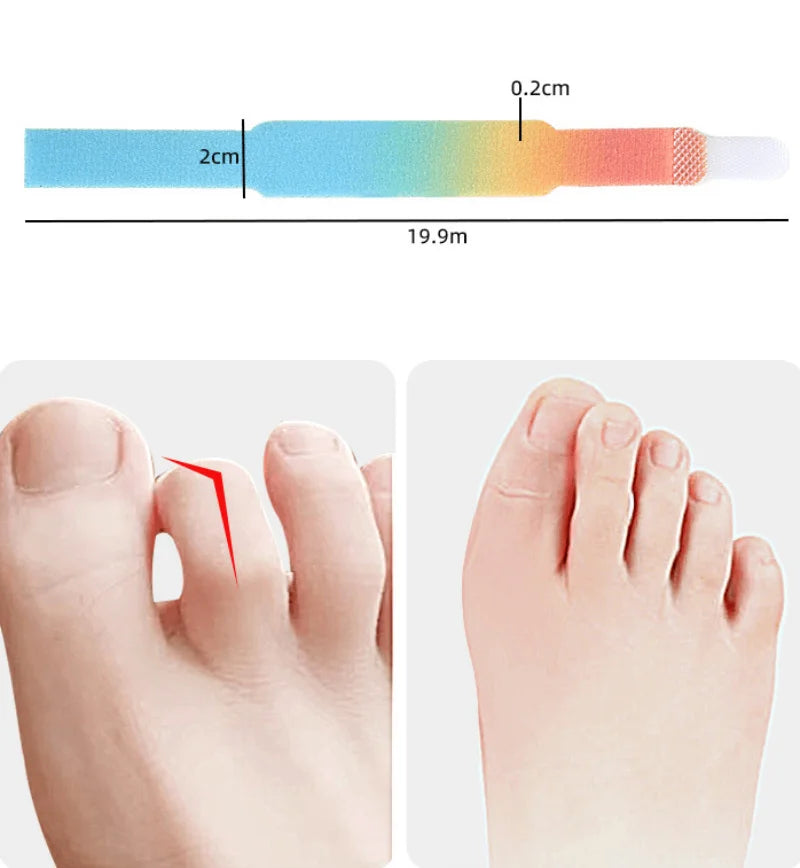 Hammer Toe Straightener - Toe Separator and Hallux Valgus Corrector Wrap
