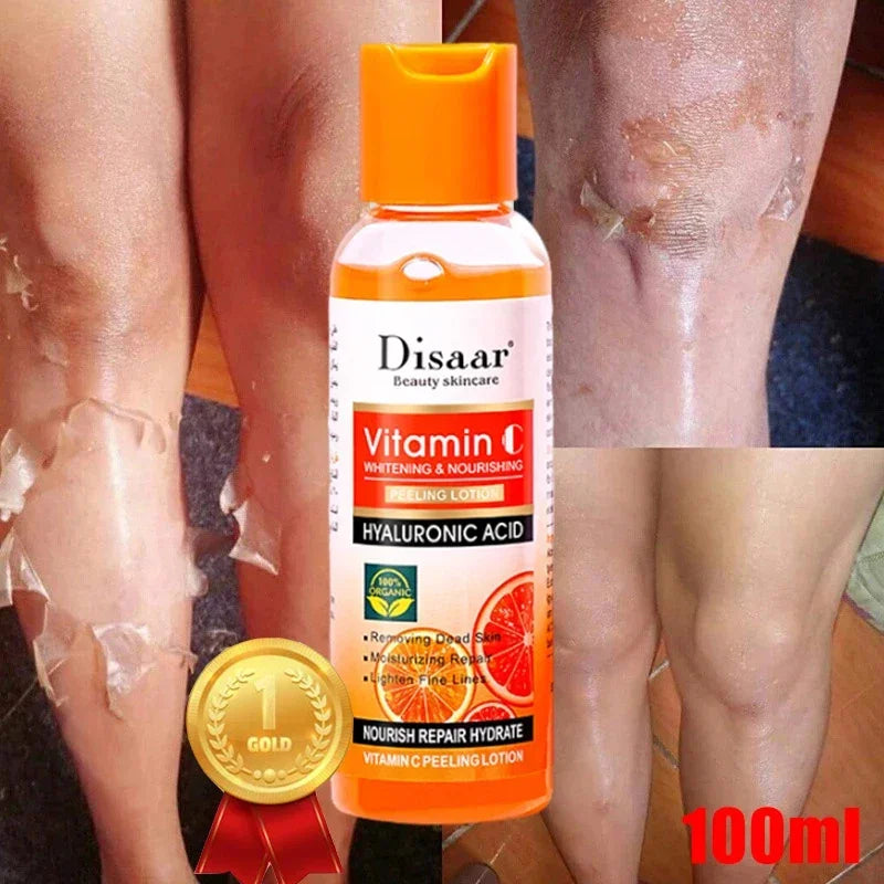 Yellow Peeling Lotion Oil – 100% Organic Exfoliating, Whitening & Nourishing Body Scrub with Hyaluronic Acid for Dark Skin