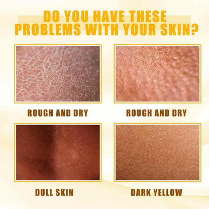 Yellow Peeling Oil – Skin Lightening & Melanin Treatment for Elbows, Knees, Hands, and Even Skin Tone