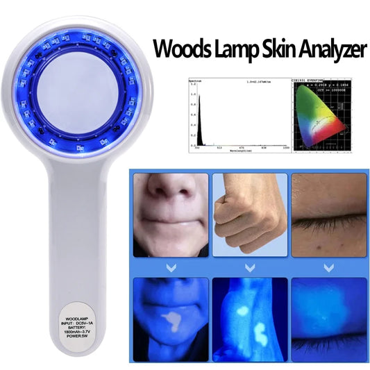 Portable Wood’s Lamp Skin Analyzer – UV Facial Beauty Diagnostic Device for Dermatology Testing & Skin Examination Salon Tool
