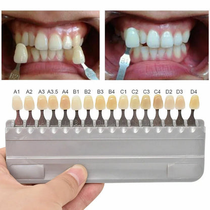 VITA 16 Colors Teeth Shade Guide – Classical Dentistry Equipment for Teeth Whitening & Porcelain Color Matching