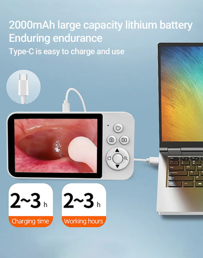 GUANMOU Digital Otoscope – 3.9mm Ear Scope Camera with 6 LED Lights, 4.3" IPS Ear Wax Removal Tool for Kids & Adults