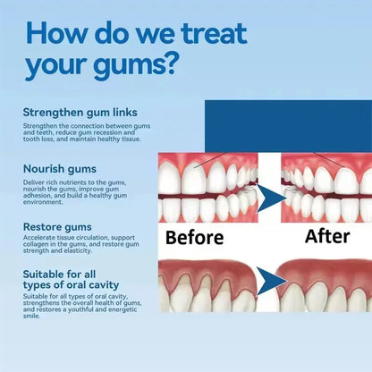 Gum Repair Care Gel | Sore Gums Relief & Deep Teeth Cleaning Serum for Stains, Tartar & Dental Health
