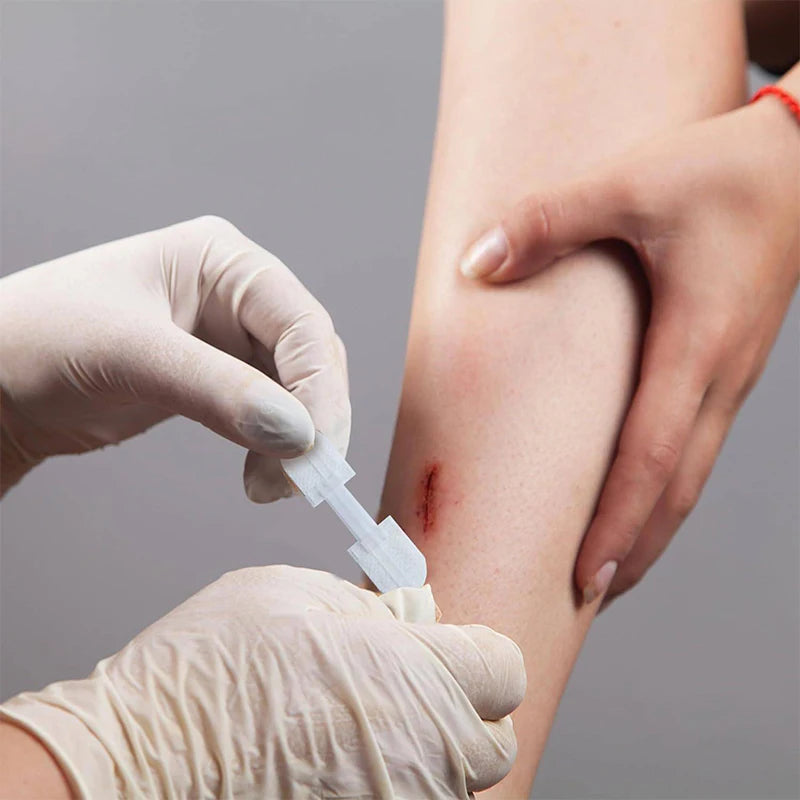 Zipper Wound Closure Patches - Painless Suture-Free Dressing for First Aid and Outdoor Use