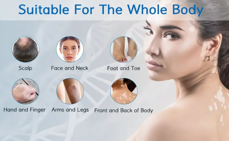 UV 311nm Phototherapy Device – Philips UVB Lamp for Vitiligo, Psoriasis & Skin Treatment