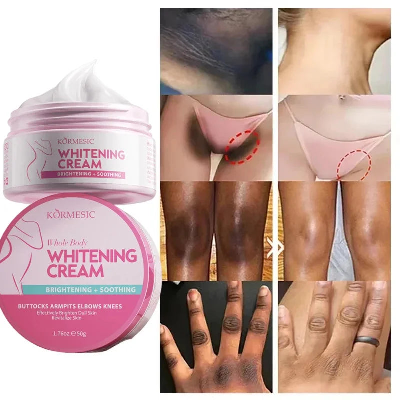 Brightening Body Cream – Underarm, Elbow & Knee Care Moisturizing Cream for Even Skin Tone, Dark Spot Care & Smooth Skin Appearance