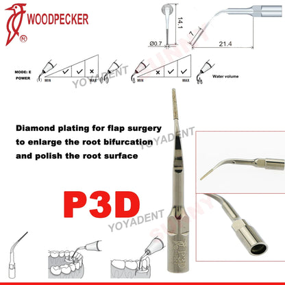 Woodpecker Dental Scaler Tips – Ultrasonic Tooth Cleaning, Endo & Perio Scaling Tips, Fit EMS UDS Scaler Handpiece
