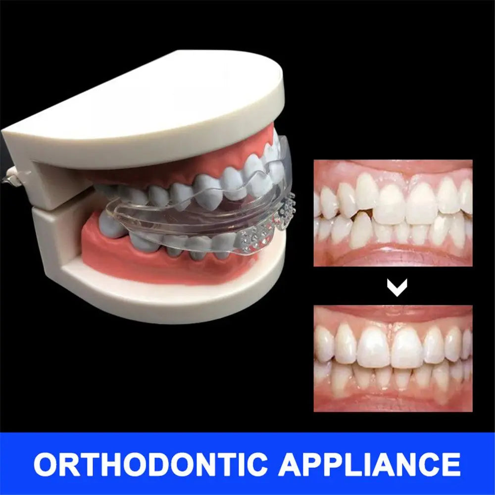 Orthodontic Braces Appliance – Silicone Teeth Alignment Trainer, Retainer for Bruxism & Teeth Straightening
