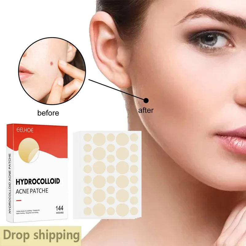 144-Piece Invisible Acne Patches - Pimple Cover Stickers for Daily Facial Skincare and Spot Care