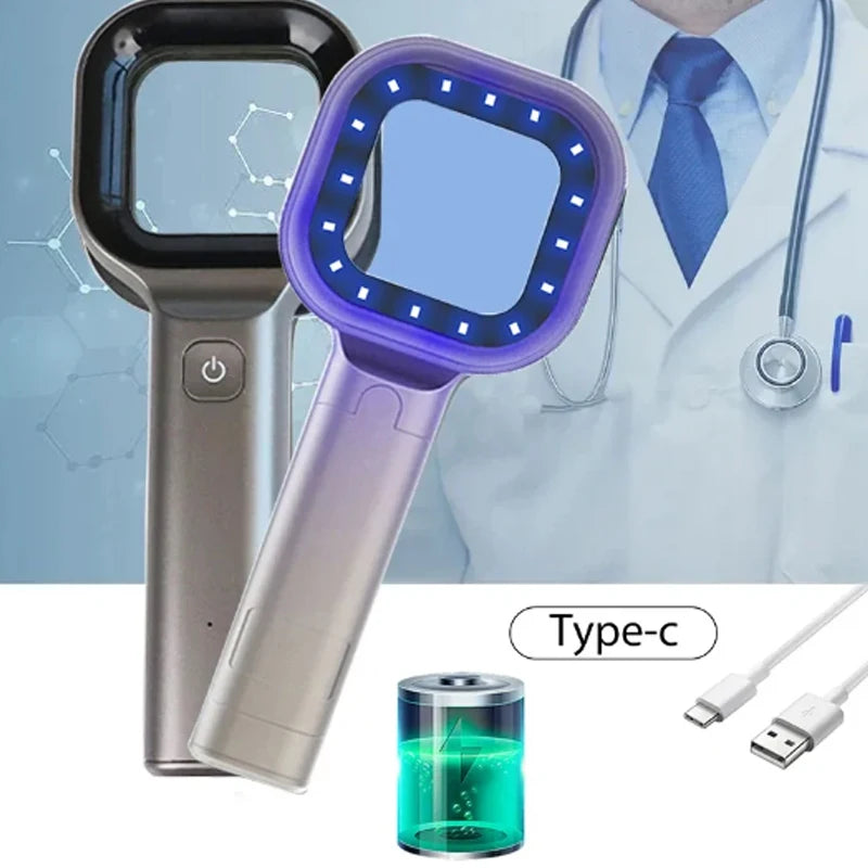 Wood’s Lamp Skin Analyzer – UV Facial Diagnostic Device for Medical Skin Examination & Beauty Care, Portable Ultraviolet Skin Testing Machine