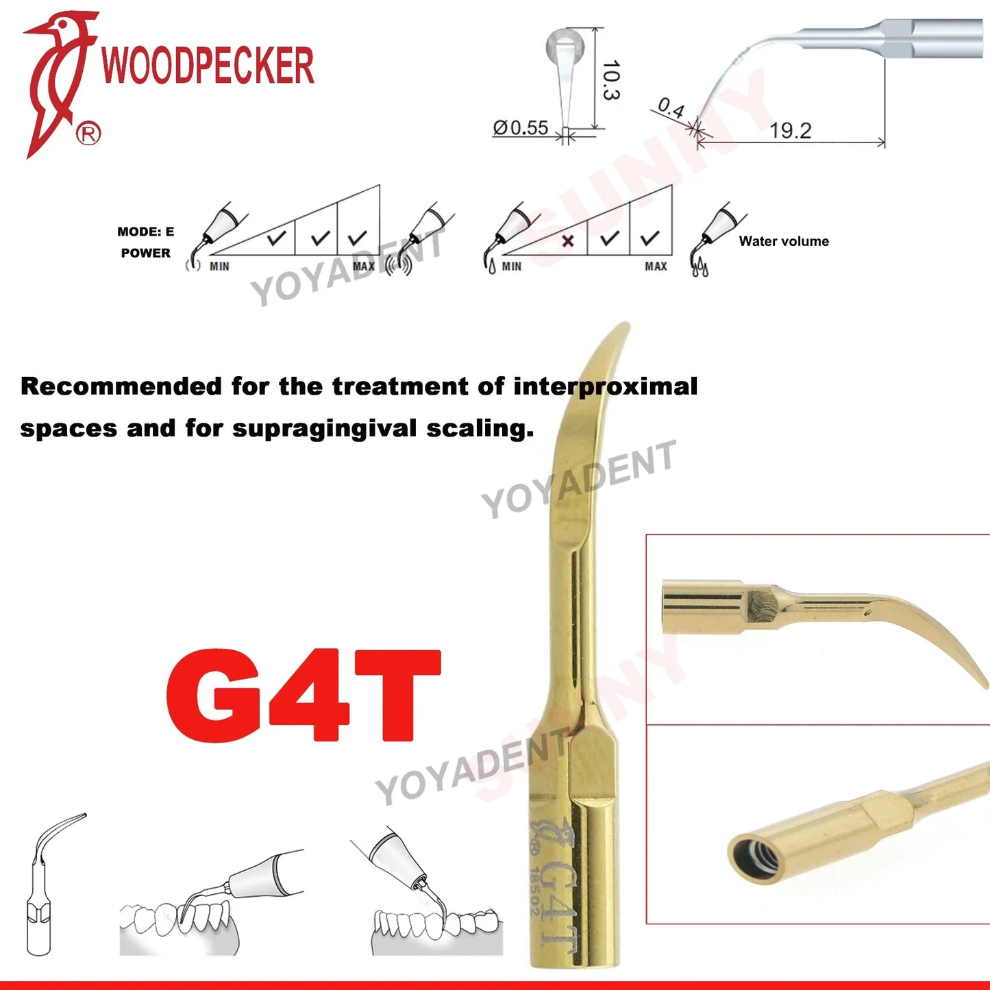Woodpecker Dental Scaler Tips – Ultrasonic Tooth Cleaning, Endo & Perio Scaling Tips, Fit EMS UDS Scaler Handpiece