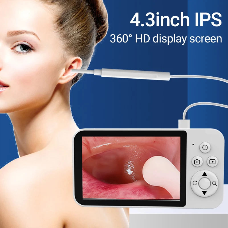 DDCAMERA 4.3" Digital Otoscope – 1080P Ear Scope with 6 LED Lights for Ear Wax Removal, Photo & Video Support