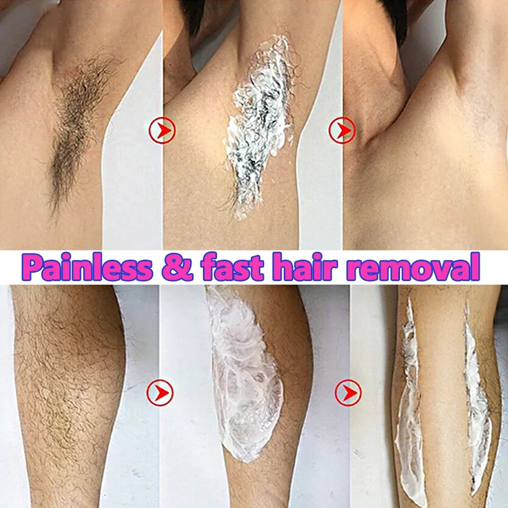 Permanent Hair Removal Cream — Painless Body & Intimate Area Epilator with Growth Inhibitor for Men & Women
