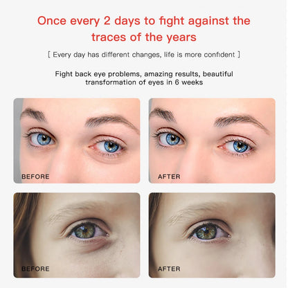 Portable 2 in 1 EMS Eye & Face Vibration Massager - Dark Circle Remover & Anti-Aging Eye Wrinkle Beauty Care Tool