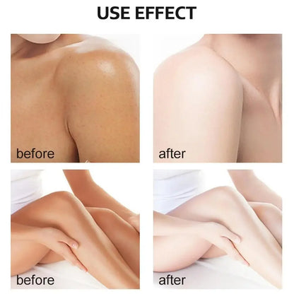 Body Care Exfoliating Yellow Peeling Oil – 100% Organic Dark Skin Whitening Serum for Dark Knuckles and Fast Bleaching