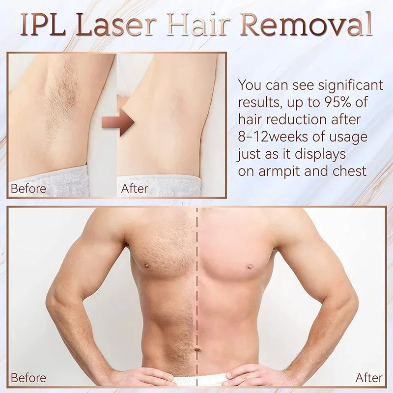 Body Bikini IPL Hair Removal Device — 999,999 Flashes Permanent Painless Laser Epilator for Women, Home Use