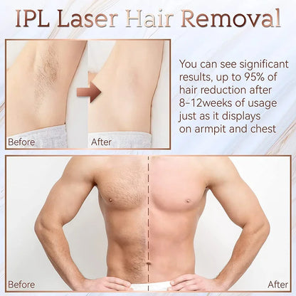 Body Bikini IPL Hair Removal Device — 999,999 Flashes Permanent Painless Laser Epilator for Women, Home Use