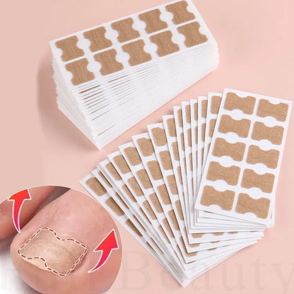 Ingrown Nail Correction Stickers - 40/100/200pcs Toenail Corrector Patches for Paronychia Treatment and Pedicure Recovery