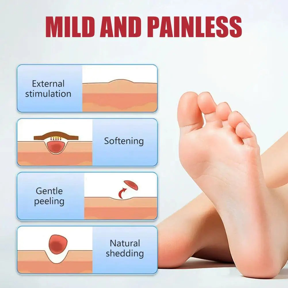 Corn Removal Patches - Breathable Foot Corn Plasters for Callus and Plantar Wart Care, 1 or 5 Pieces