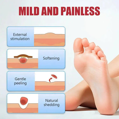 Corn Removal Patches - Breathable Foot Corn Plasters for Callus and Plantar Wart Care, 1 or 5 Pieces