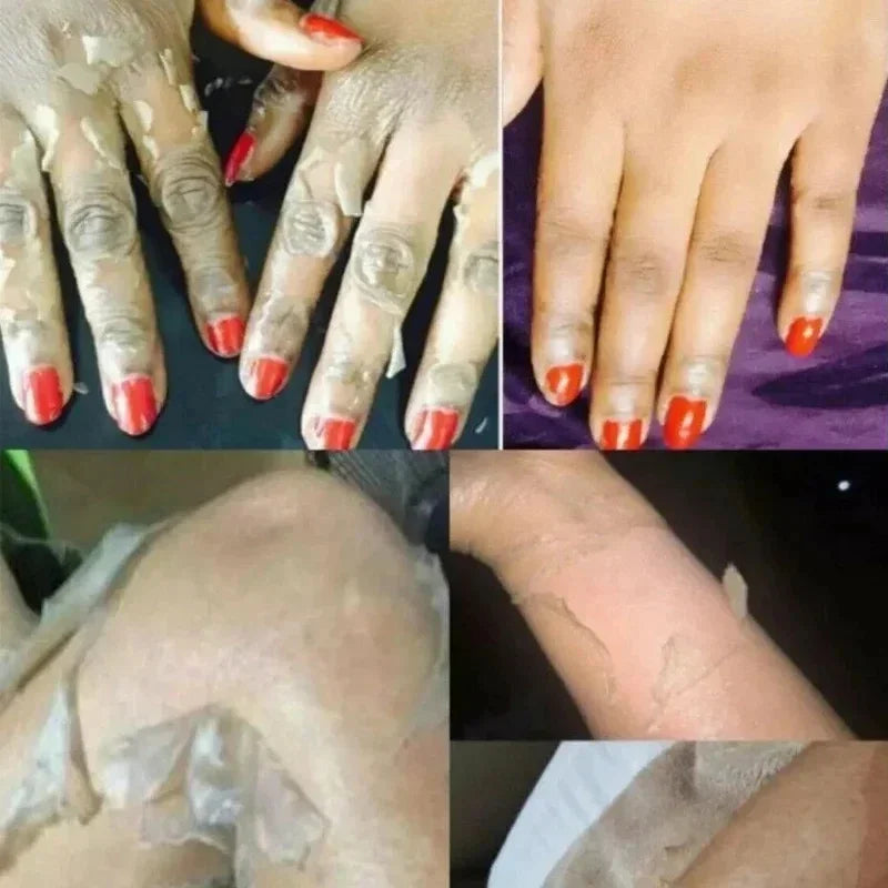 Body Care Exfoliating Yellow Peeling Oil – 100% Organic Dark Skin Whitening Serum for Dark Knuckles and Fast Bleaching