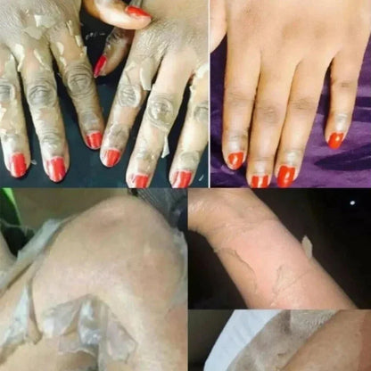 Body Care Exfoliating Yellow Peeling Oil – 100% Organic Dark Skin Whitening Serum for Dark Knuckles and Fast Bleaching