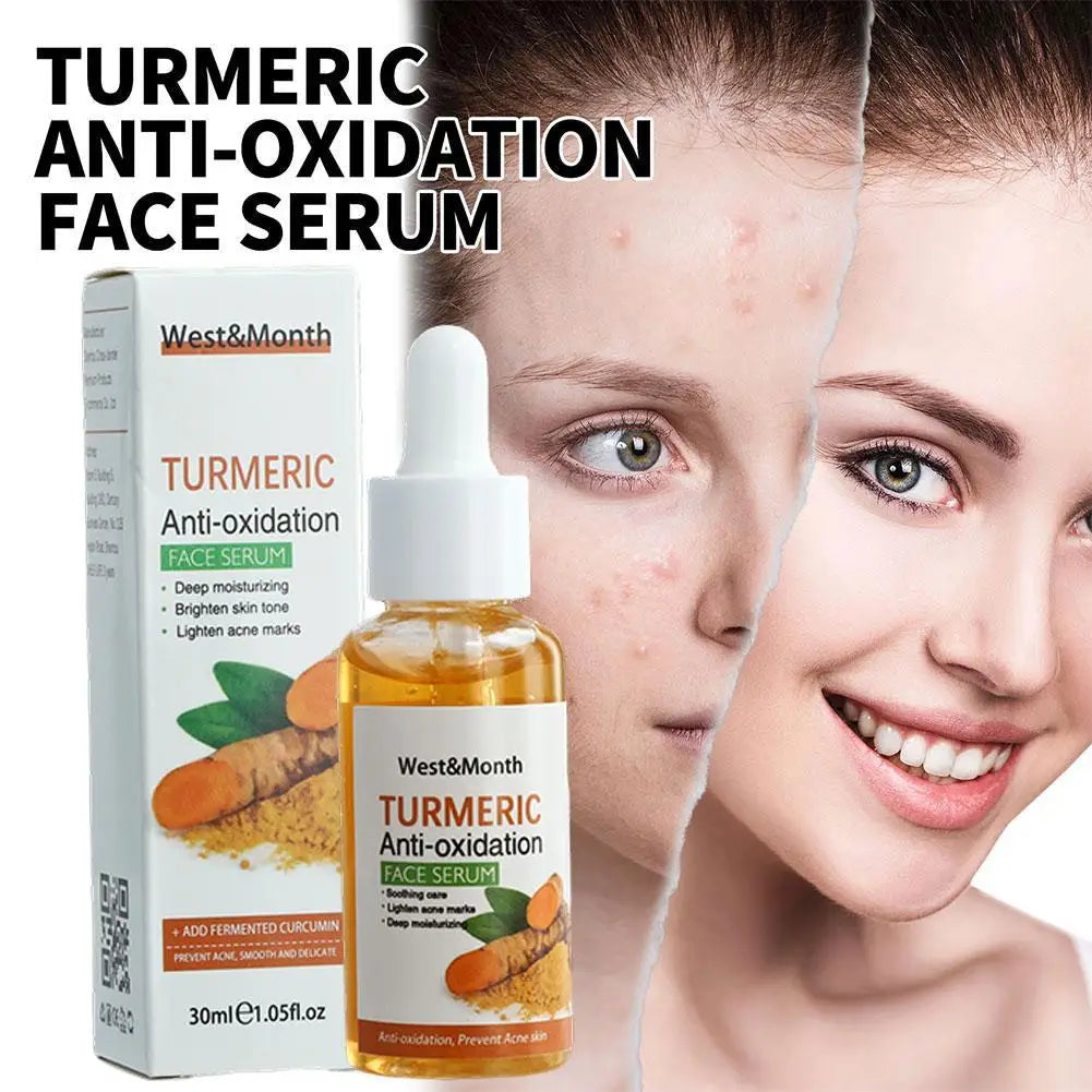 Turmeric Face Whitening Serum – Anti-Oxidation Dark Spot Corrector for Facial Brightening & Skin Clarity