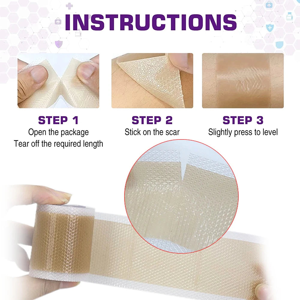 Medical-Grade Silicone Scar Sheets Roll - Reusable Treatment for Keloid, C-Section, Surgery & Burns - Professional Scar Care Solution