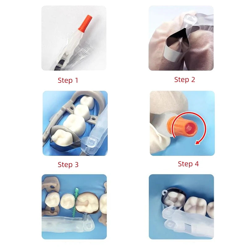 Preformed Dental Matrix Bands – Adjustable Sectional Matrix System for Crowns