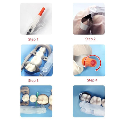 Preformed Dental Matrix Bands – Adjustable Sectional Matrix System for Crowns