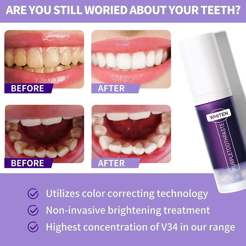 V34 Teeth Whitening Toothpaste – 5D Whitening Stick for Oral Hygiene, Cleaning & Fresh Breath Care